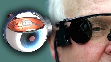 Bionic Eye Cures Blindness