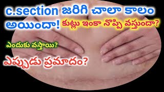 c section stitches pain reasons in telugu/after delivery mother care