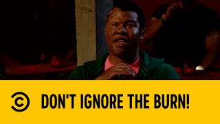 Don't Ignore The Burn! | Key & Peele | Comedy Central Africa