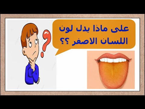 لون اللسان الاصفر يدل على مرض ما