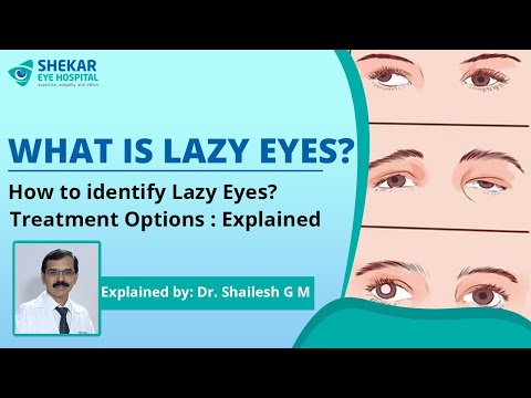 How to identify lazy eyes? Treatment Options : Explained