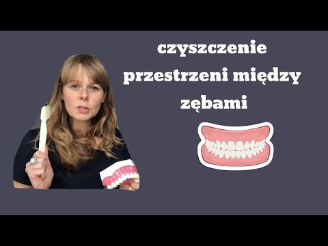 Wideo: Jama Międzyzębowa: Jama Między Zębami