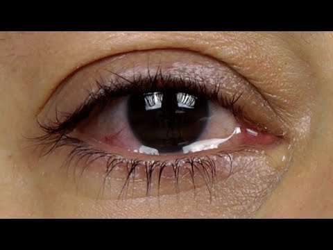 Why does not tear-free shampoo sting your vision?