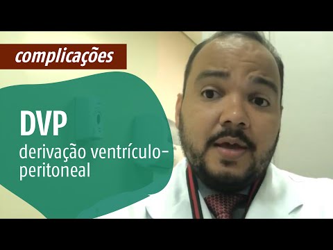 Vídeo: Os Médicos Contaram Sobre Um Caso único De Hidrocefalia - Visão Alternativa