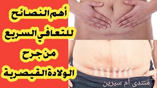 خطوات سهلة👌 يجب اتباعها للتعافي السريع من جرح الولادة القيصرية 🌸🤰