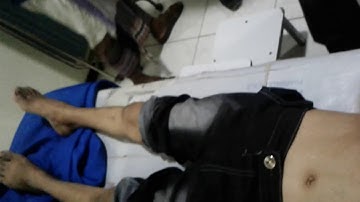 Friedreich Ataxia - A case prepared by Prof. Saleh Al-Awdhaly