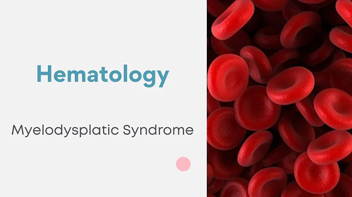 Hematology | Myelodysplatic Syndrome