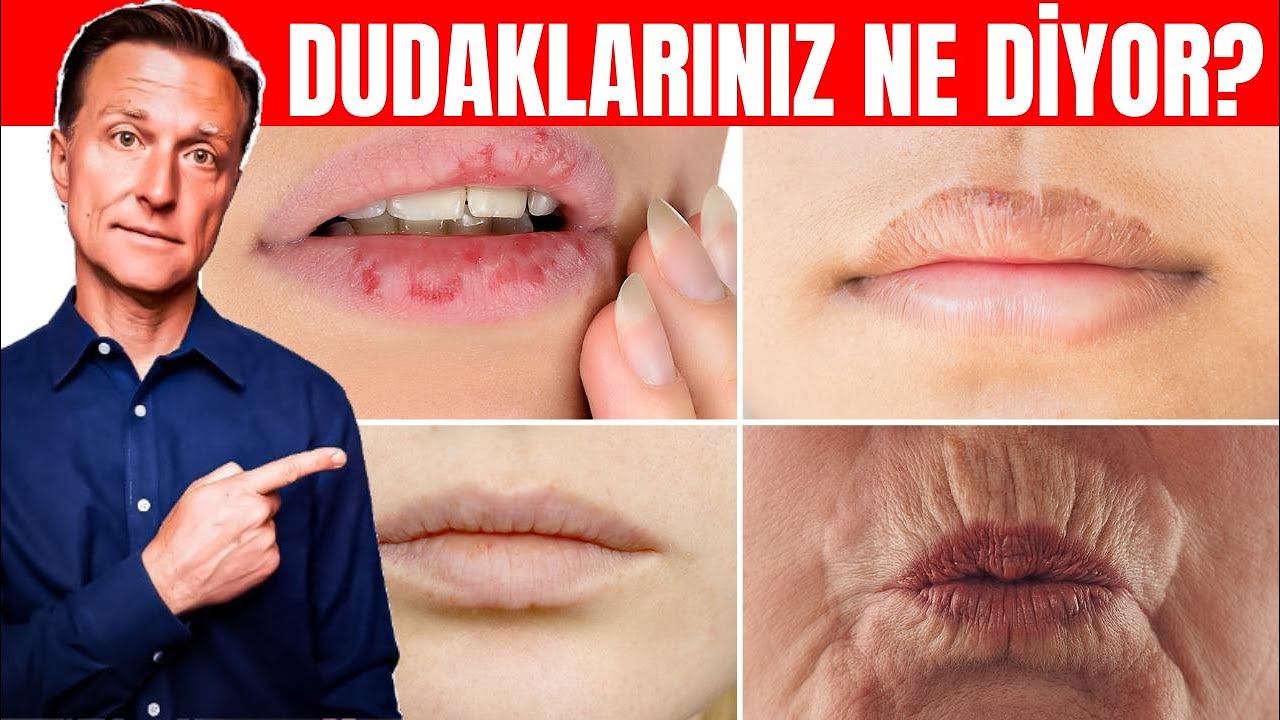 Dudaklarınızın Beslenme Durumunuz Hakkında Söylediği 5 Şey | Dr.Berg Türkçe