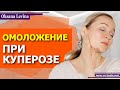 Массаж лица на 10 дней для улучшения кожи. КУПЕРОЗ не приговор!