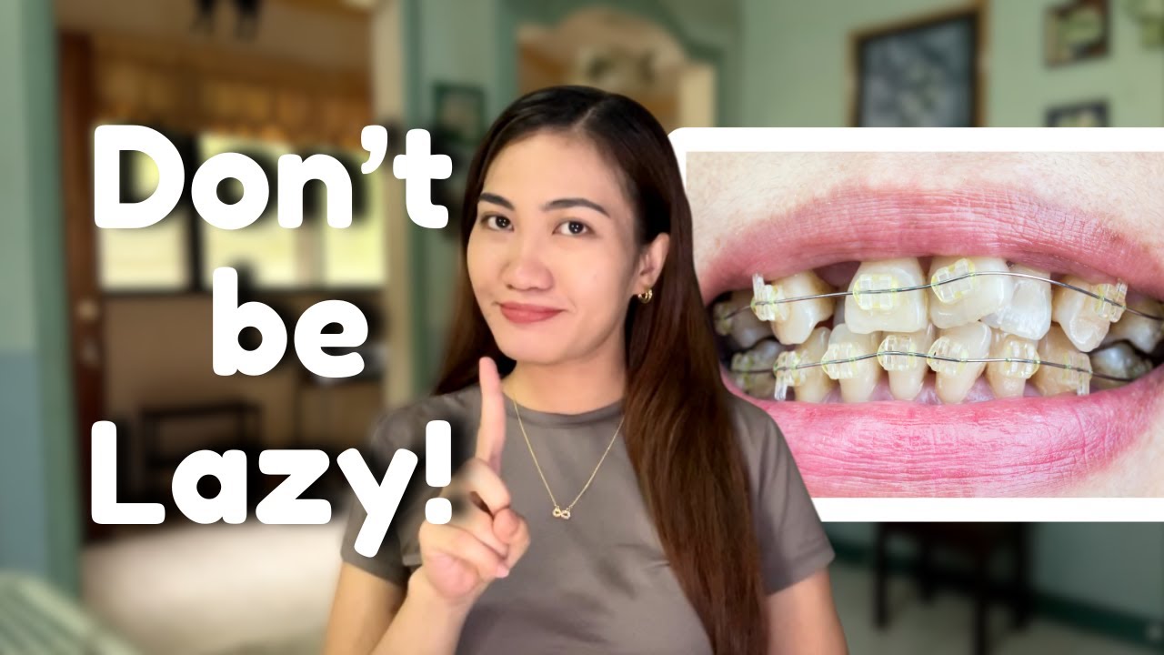 What NOT To Do When You First Get Braces