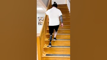 Rich | Rotationplasty Amputee Shows Off Incredible Gait Control