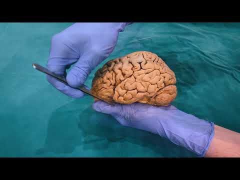 Gehirnwindungen? Sulci & Gyri kurz und knapp mit Prüfungsfragen | Sezierkurs Live Anatomie Innsbruck