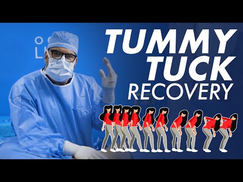 What is Dr. Ravi's World Renowned SMART Tummy Tuck? Learn more about this  amazing procedure. 