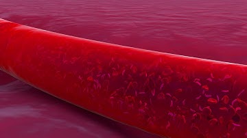 3D Animation - Anemia