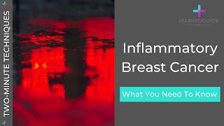 Two Minute Techniques - Inflammatory Breast Cancer