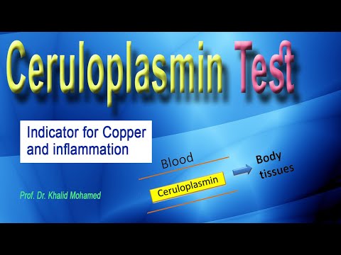 Ceruloplasmin Test: اختبار السيرولوبلازمين