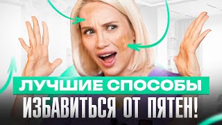 Как избавиться от пигментных пятен - 6 лучших способов