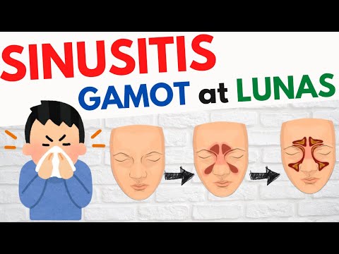 Video: Paano Kilalanin ang Mga Sintomas ng Japanese Encephalitis: 11 Mga Hakbang