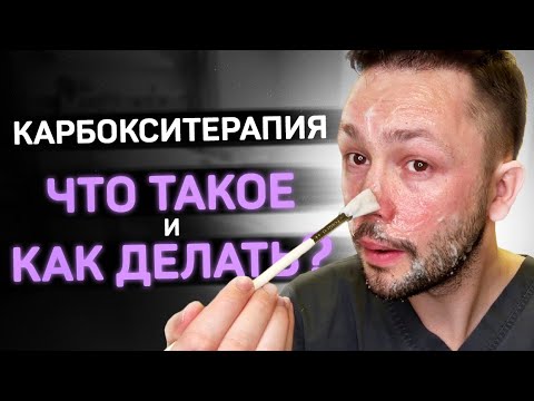 Карбокситерапия от черных точек и морщин. Показываю процедуру.