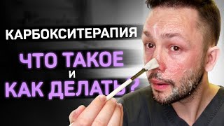 Карбокситерапия от черных точек и морщин. Показываю процедуру. - Видео от Игорь Патрин