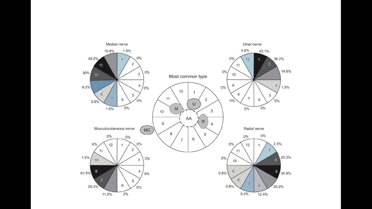 USG guided Axillary Block Presentation - YouTube