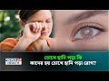 ঔষধের মাধ্যমে কি চোখে ছানি পড়া ভালো হয় ? | Health Tips Bangla | Cataract | News24 Health
