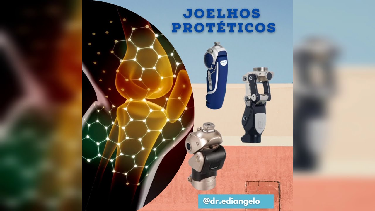 Joelhos Protéticos