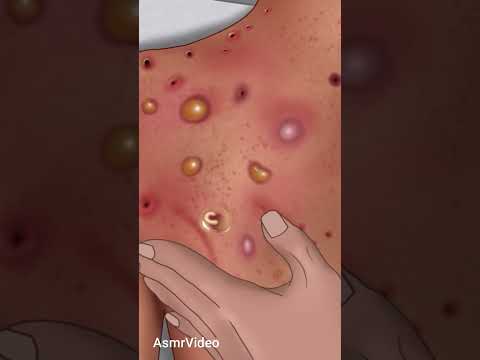 cactus Asmar Treatment #asmrvideo #shorts