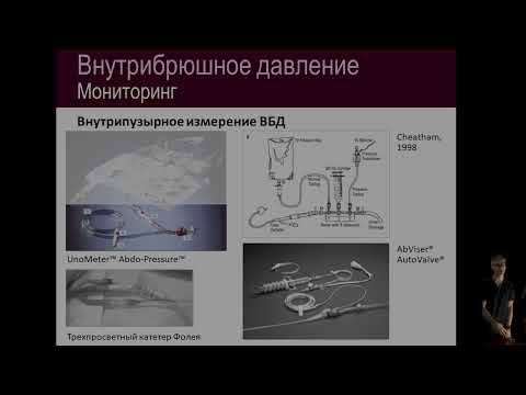 Синдром абдоминального компартмента