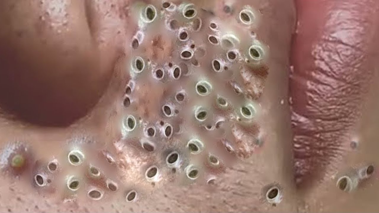 𝐂𝐡𝐢𝐥𝐥 𝐘𝐨𝐮𝐫 𝐋𝐢𝐟𝐞 𝐖𝐢𝐭𝐡 𝐋𝐍𝐆 𝐒𝐤𝐢𝐧 𝐂𝐚𝐫𝐞 