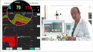 What Are The Hemodynamics Effect Of Acute Hypercapnia And Acute Hypoxia