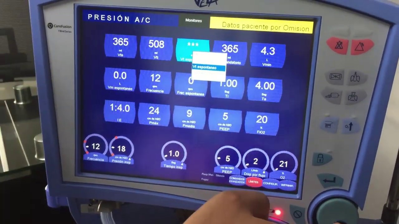 Verificación del funcionamiento y prueba de fugas - Ventilador Pediátrico CAREFUSION VELA