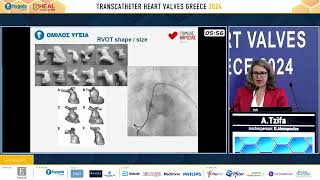 A. Tzifa | 1. Transcatheter interventions for the pulmonic valve