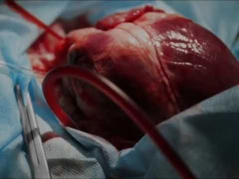 ربنا لا تزغ قلوبنا بعد إذ هديتنا محمد اللحيدان