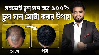 চুল পড়া বন্ধ ও নতুন চুল গজানোর উপায় | চুল গজানোর উপায় | টাক মাথায় চুল গজানোর উপায় |  screenshot 2