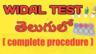 Widal test in telugucompete procedure