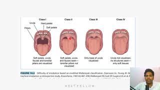 Anesthesia Airway Examination concept for NEETPG,FMGE,INICET,NEXT. screenshot 5