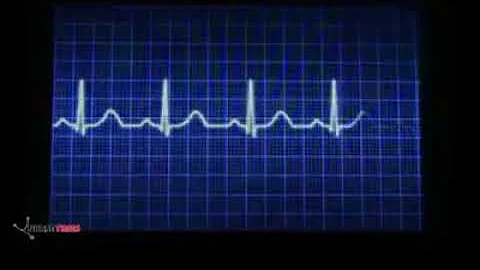 Quando il ritmo cardiaco viene modificato?