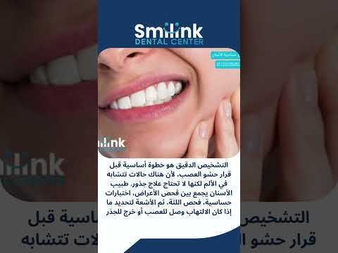 متى تحتاج حشو عصب؟ علامات لا يجب تجاهلها