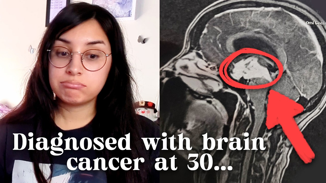 so... I have a brain tumour. | brain surgery and personal update