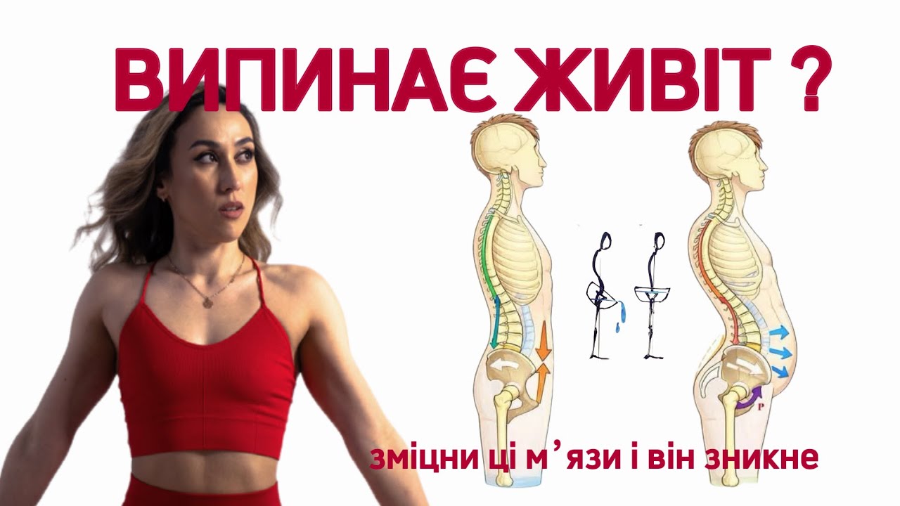 ТВІЙ ЖИВІТ ЗНИКНЕ , гіперлордоз , нахил тазу, не тримання сечі , біль в попереку, випинаючий живіт