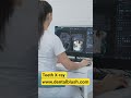 How Dental X-Rays Detect Hidden Tooth Problems || #teethcleaning #dentalblush