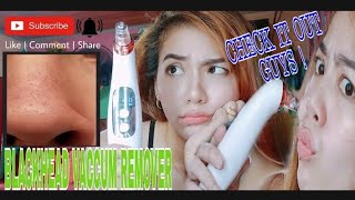 Blackheads Vaccum Remover ‼ Nakakatanggal talaga sya 101% ‼ | Honest Reviews | Vlog 27