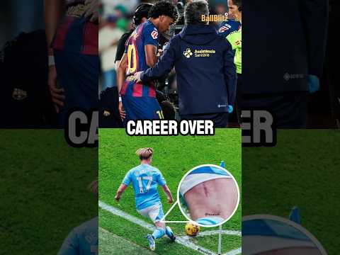 Video How Yamals injury ended De Bruynes career and could affect Yamal career too!