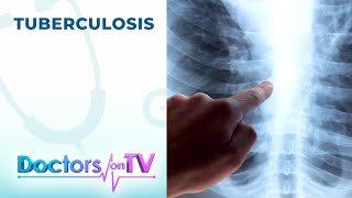 TUBERCULOSIS: Symptoms and Treatment | DOTV