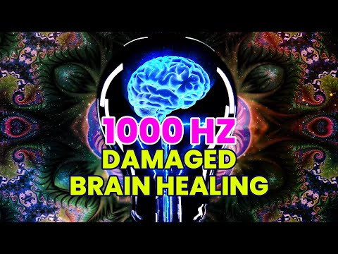 Damaged Brain Healing & Nerve Regeneration | 1000 Hz Cerebral Neuron Damage Healing | Binaural Beats