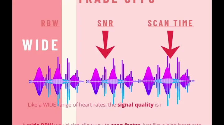 MRI Parameters: RBW, SNR, Scan Time