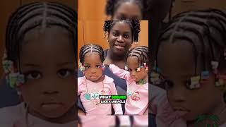 Formerly Conjoined Twin Azora Elson Passed Away