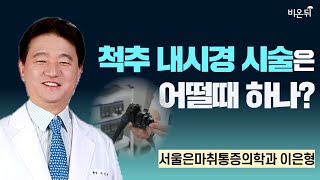 척추 내시경 시술은 어떨때 하나? / 서울은마취통증의학과 이은형