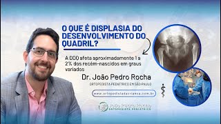 O Que é Displasia do Desenvolvimento do Quadril? Diagnóstico, Tratamento 🦴 #desenvolvimentoinfantil O Que é Displasia do Desenvolvimento do Quadril? Diagnóstico, Tratamento 🦴 #desenvolvimentoinfantil